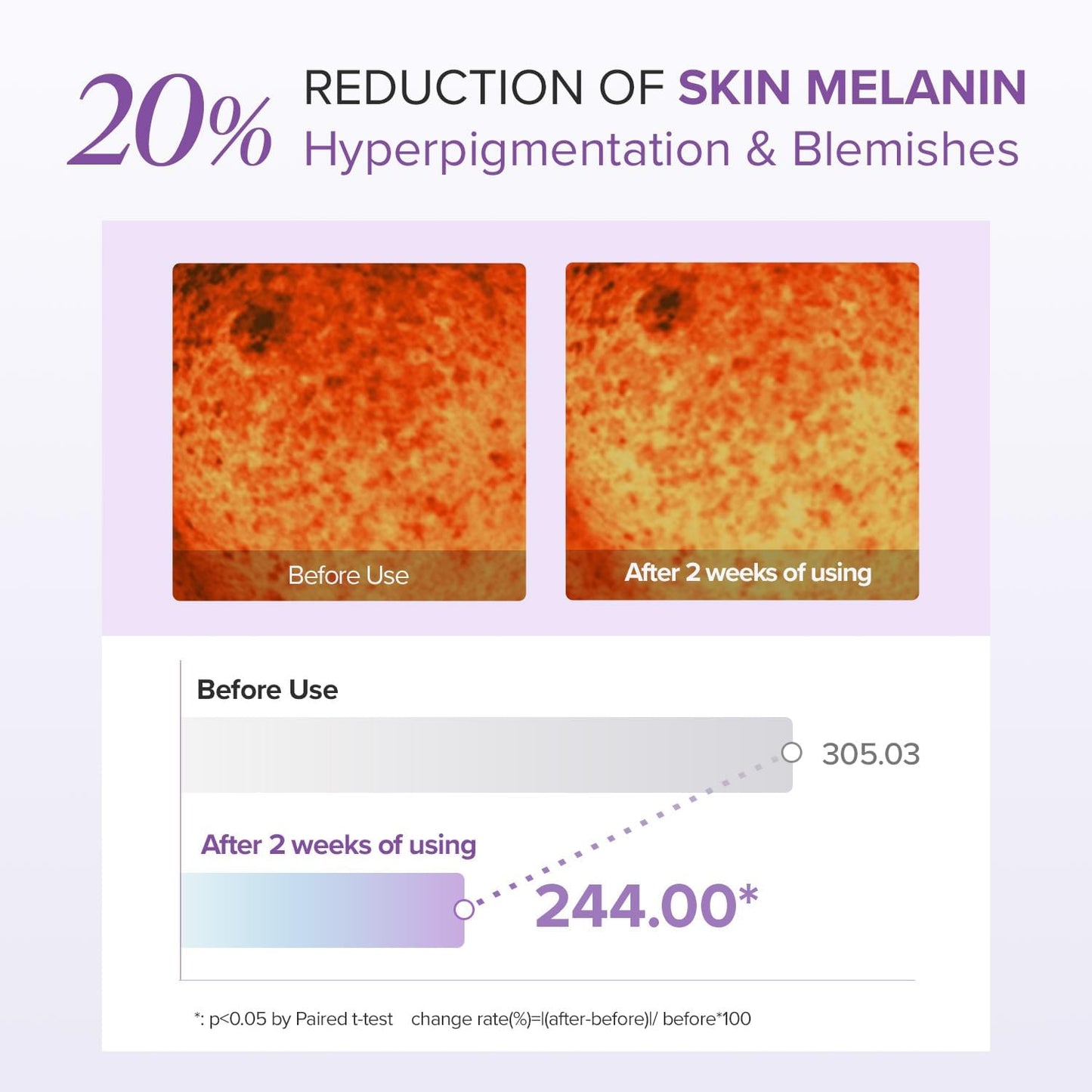 Tranexamic Acid + Glutathione Eye Cream