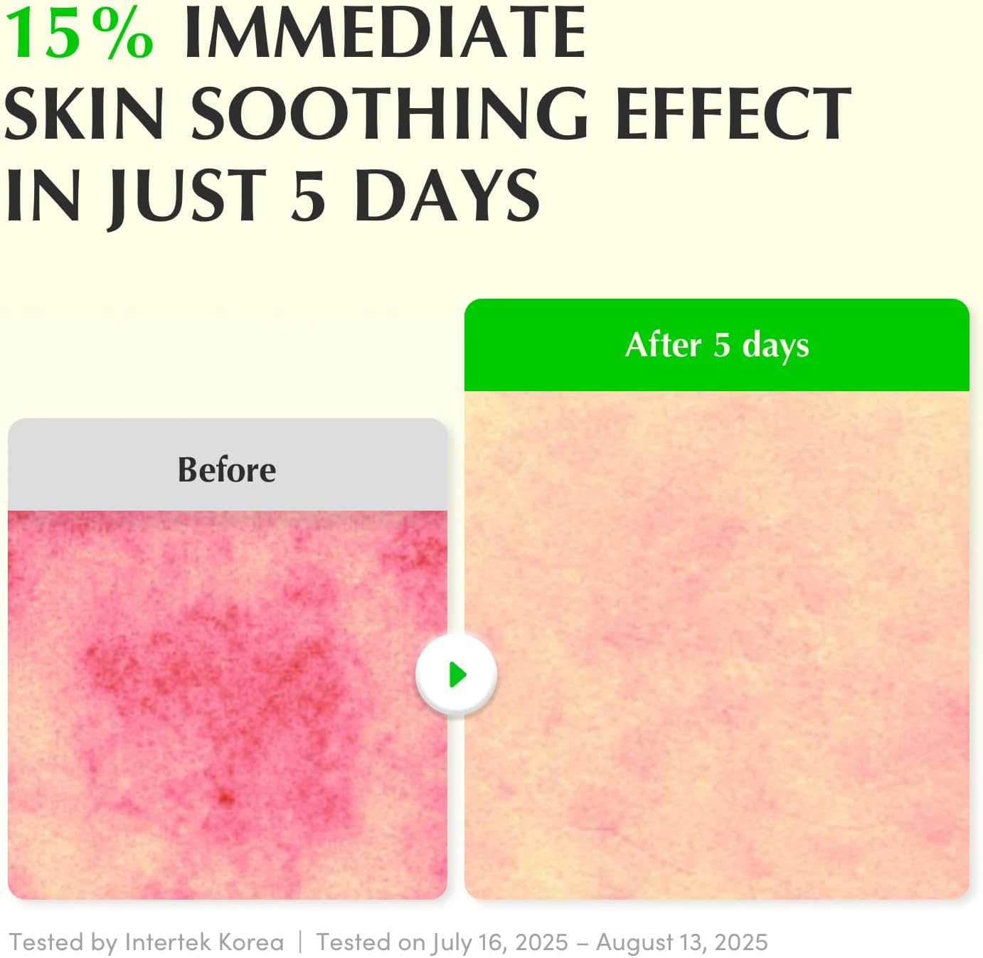 EQQUALBERRY Aloe PDRN calming Serum