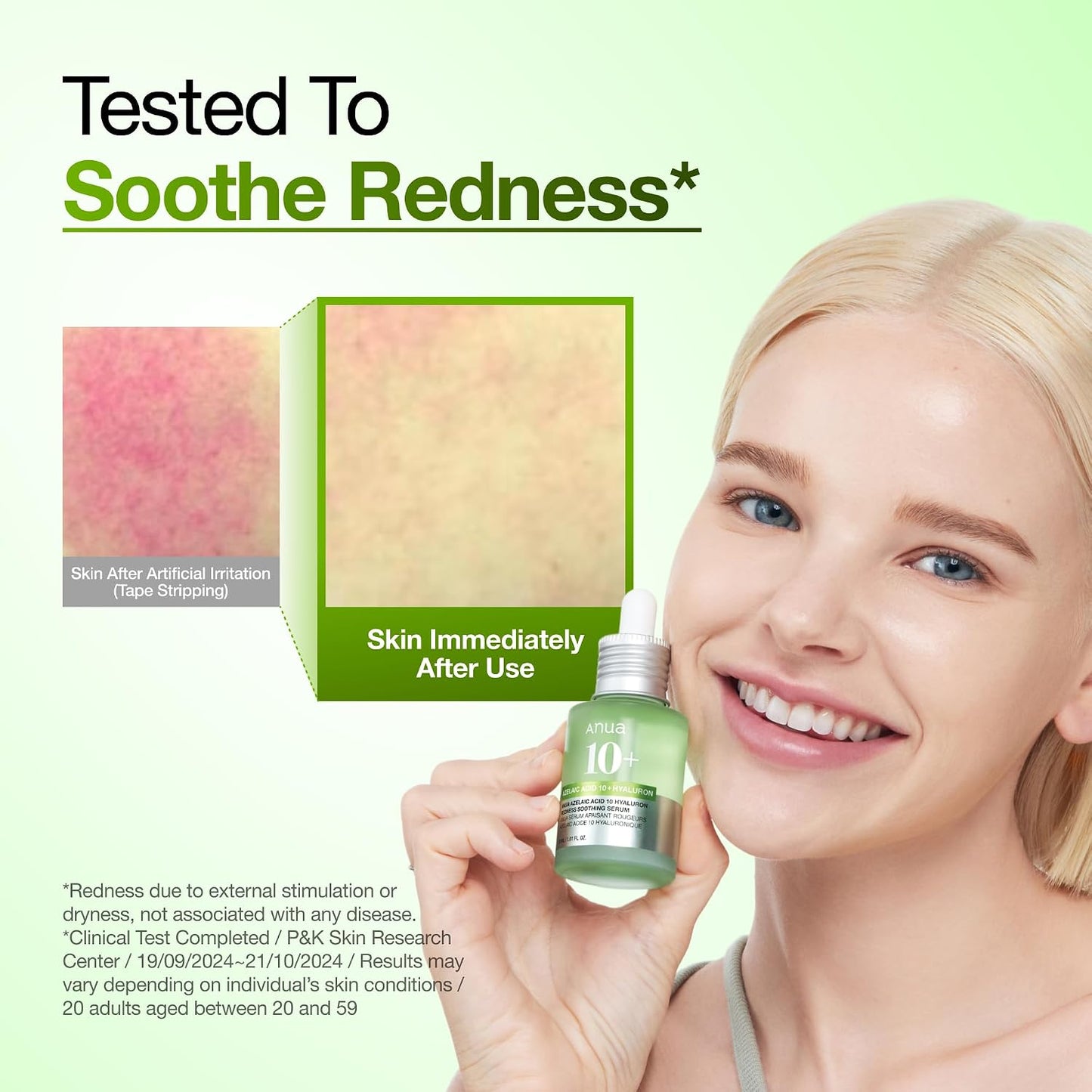 ANUA - Azelaic Acid 10 Hyaluron Redness