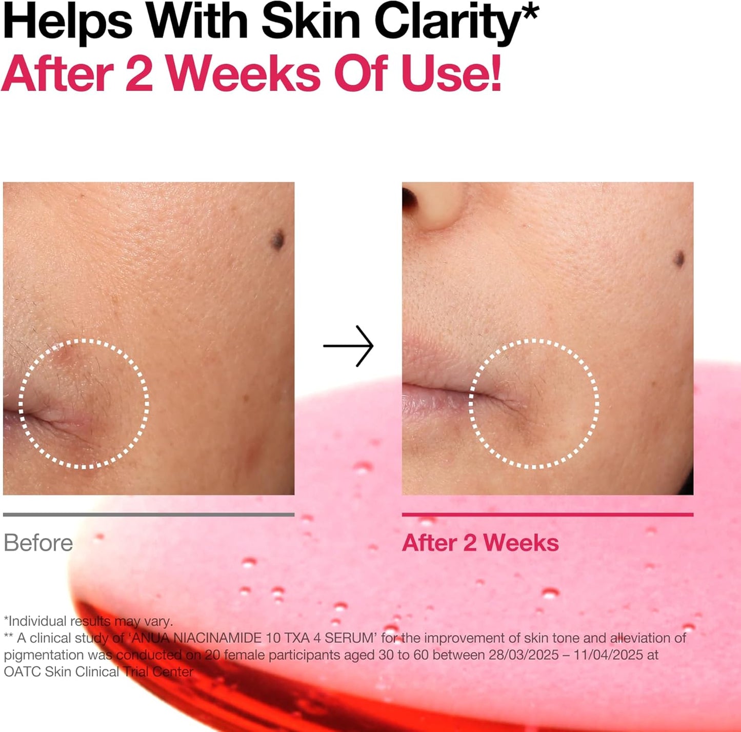 ANUA - NIACINAMIDE 10% + TXA 4%