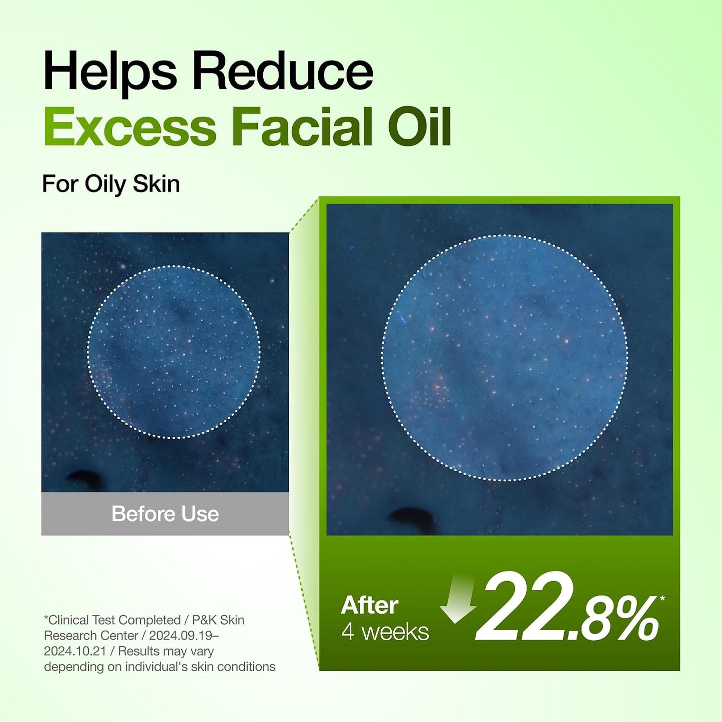 ANUA - Azelaic Acid 10 Hyaluron Redness